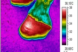 Hufgelenkentzündung